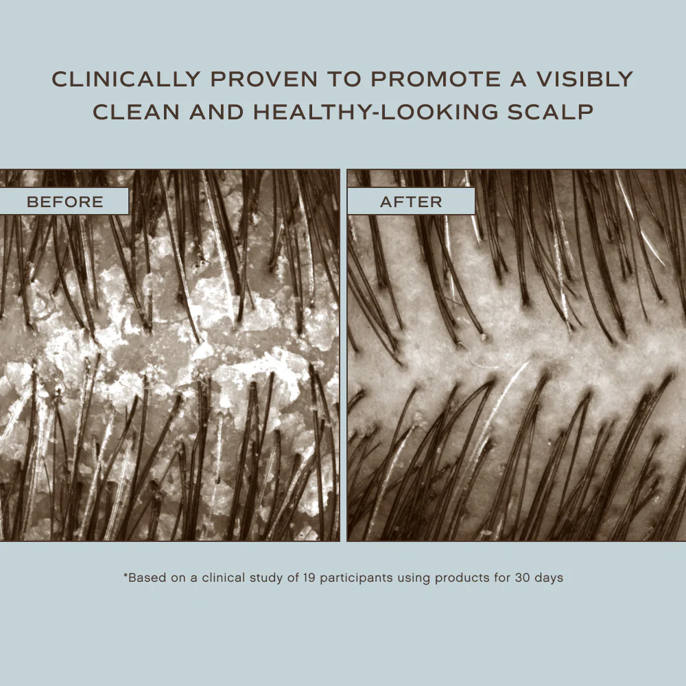 INNERSENSE-Organic-Beauty-Hair-Renew-Scalp-Hairbath-before-after