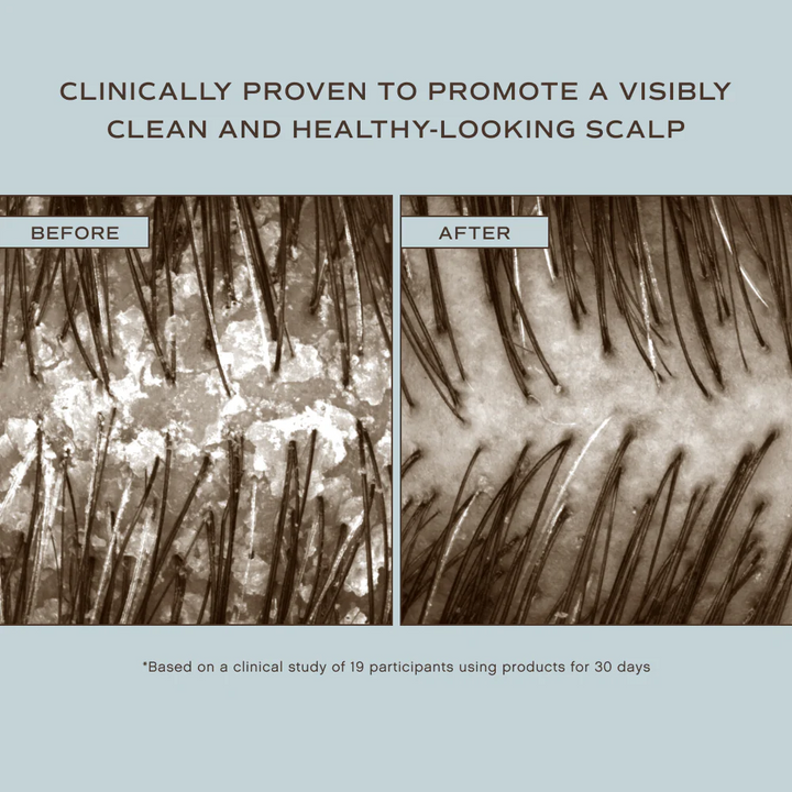 INNERSENSE-Organic-Beauty-Hair-RenewSoothing-Conditioner-before-after