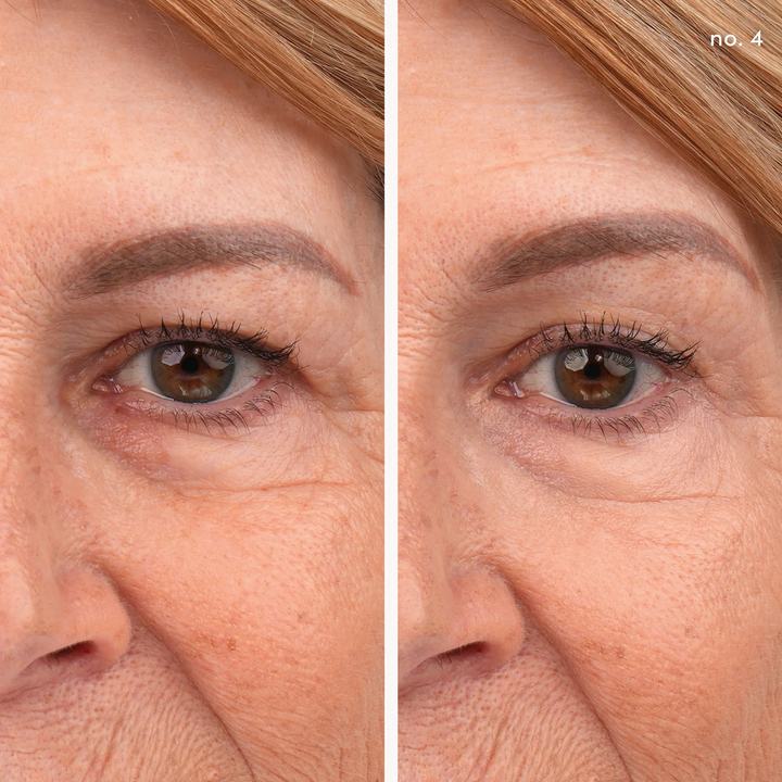 Jane Iredale Active Light Under-Eye Concealer before after no 4