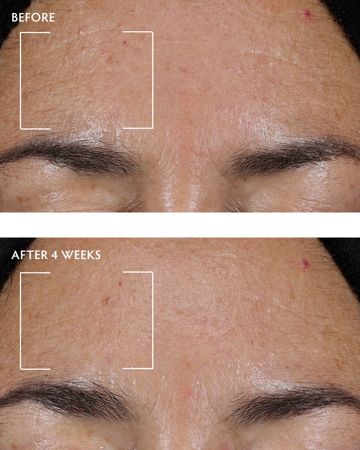 Naturopathica-Caffeine-Peptide-Hydrating-Face-Neck-Serum-before-after