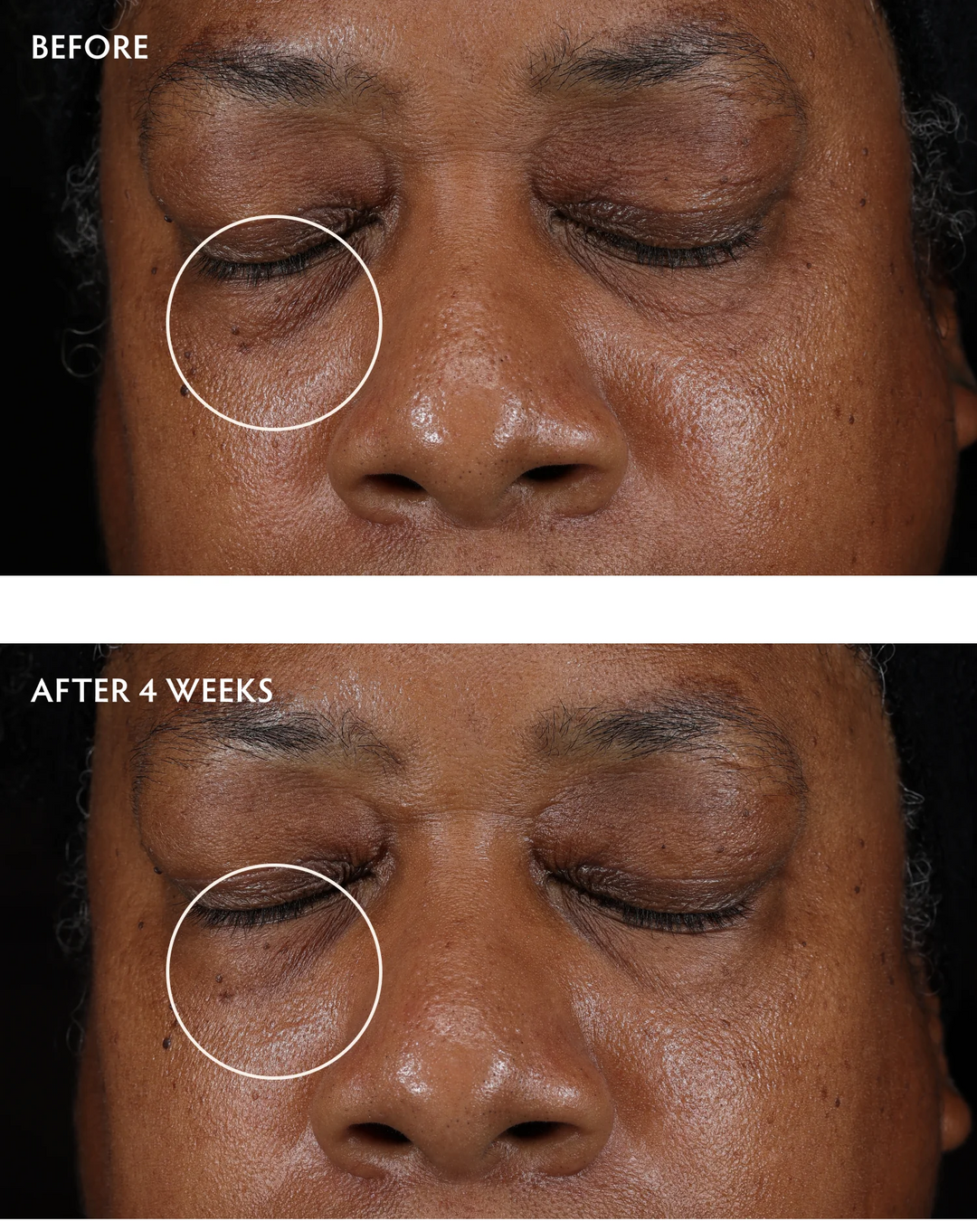 Naturopathica-Caffeine-Peptide-Smoothing-Eye-Serum-before-after-2