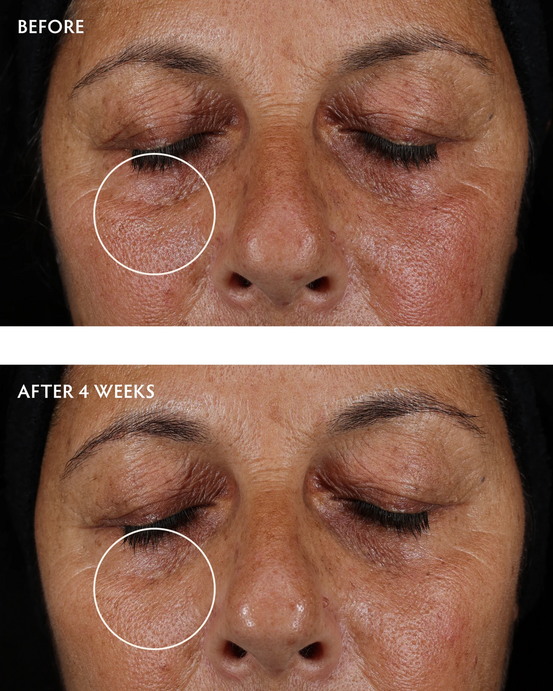 Naturopathica-Caffeine-Peptide-Smoothing-Eye-Serum-before-after