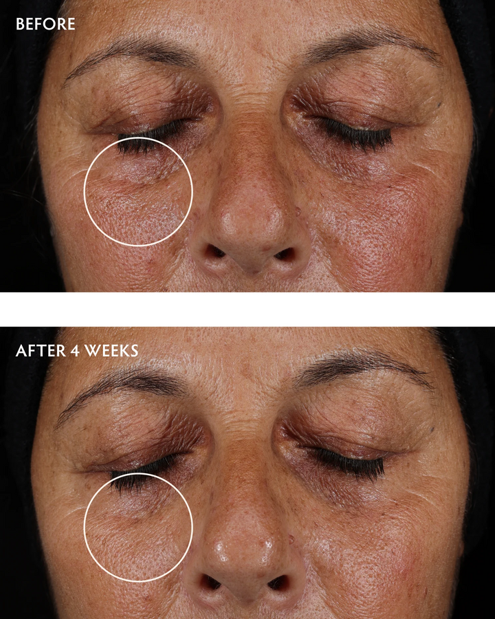 Naturopathica-Caffeine-Peptide-Smoothing-Eye-Serum-before-after