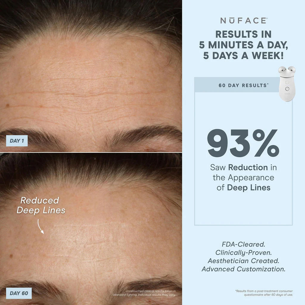 NuFACE TRINITY + Complete Set with Wrinkle Reducer and Effective Lip & Eye Attachment
