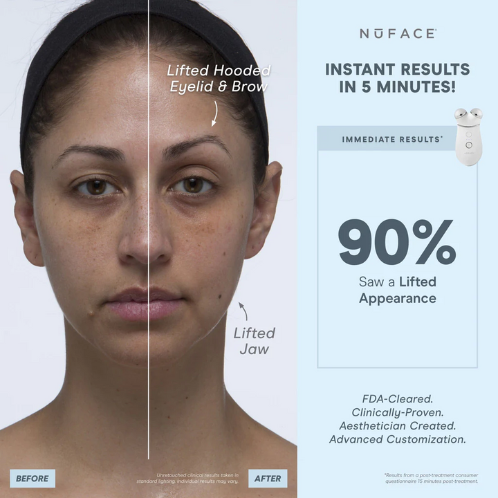NuFACE TRINITY + Complete Set with Wrinkle Reducer and Effective Lip & Eye Attachment