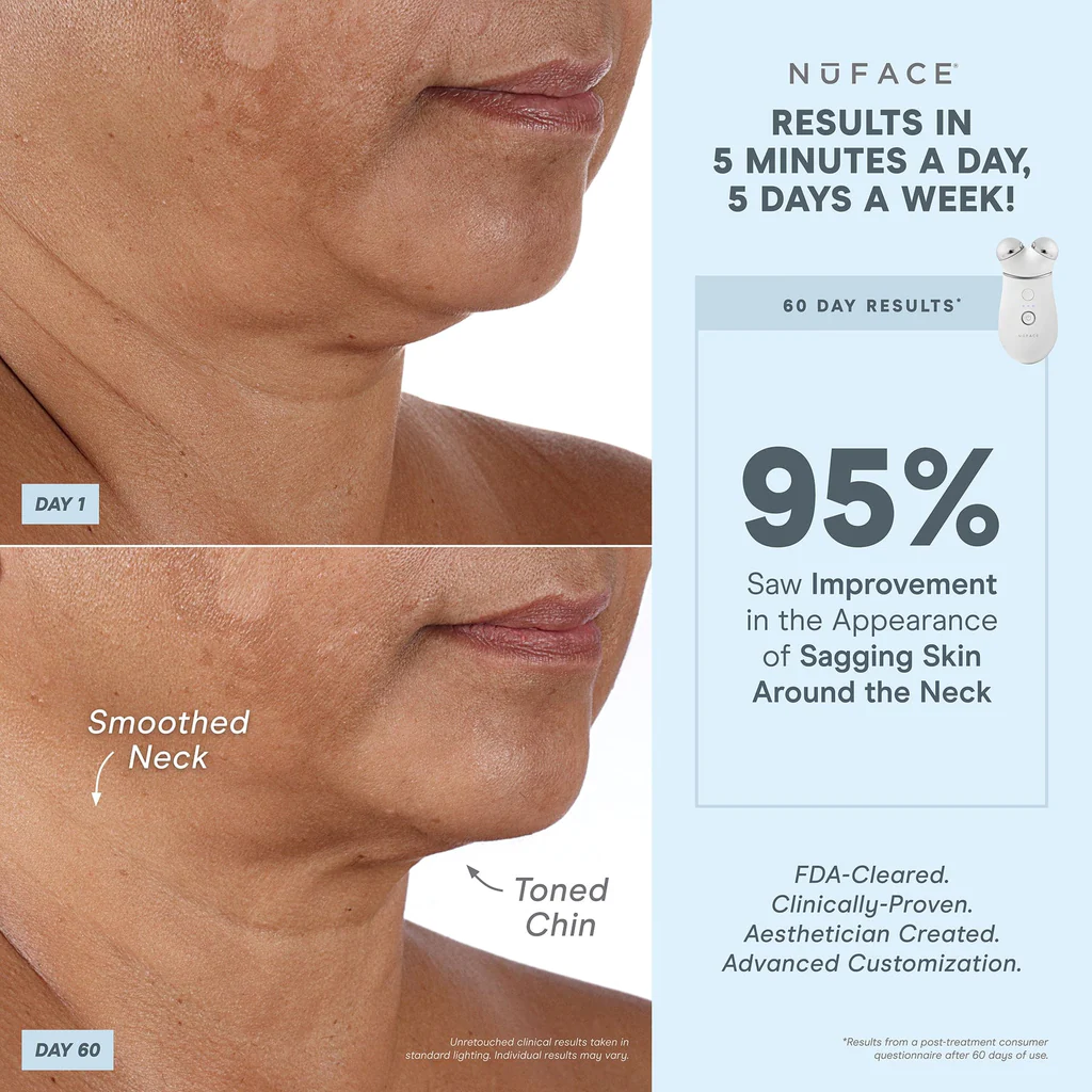 NuFACE TRINITY + Complete Set with Wrinkle Reducer and Effective Lip & Eye Attachment