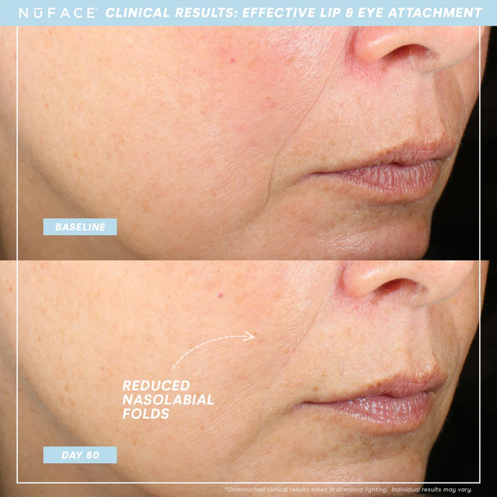 NuFACE TRINITY + Effective Lip & Eye Attachment