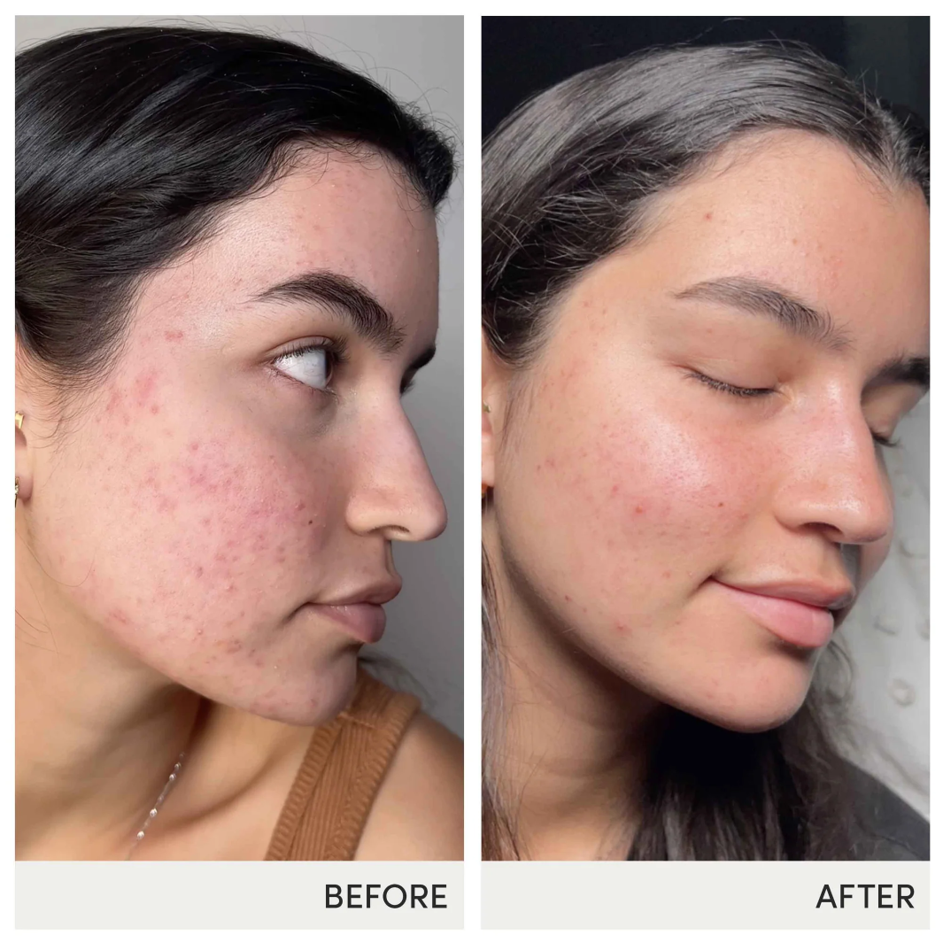 Jane Iredale Skin Accumax