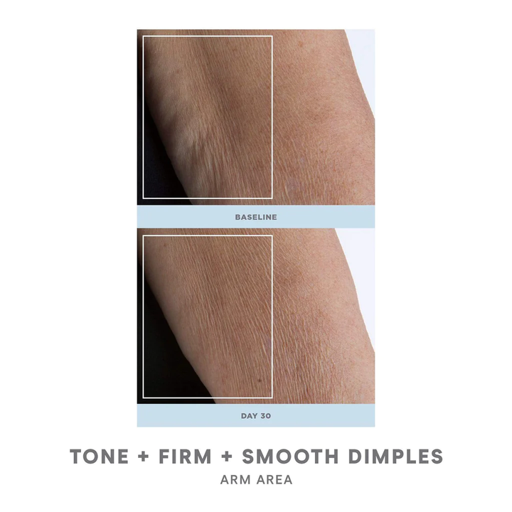 NuFACE NuBODY Body Toning Device before after arms 2