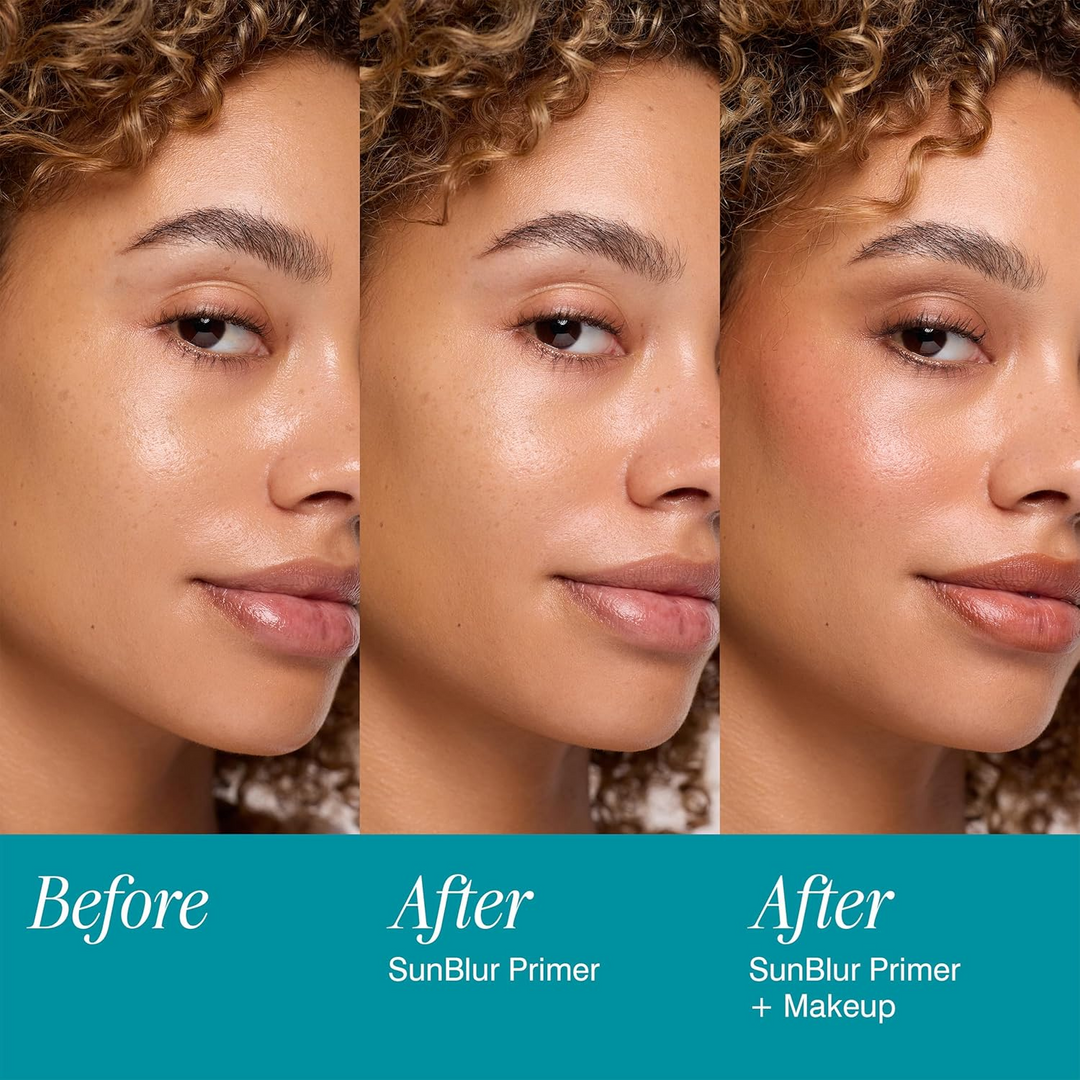Before and After comparison of a woman&