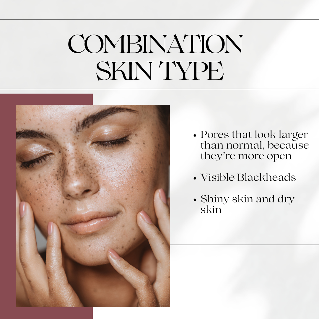Skin Types – Natural Beauty Group
