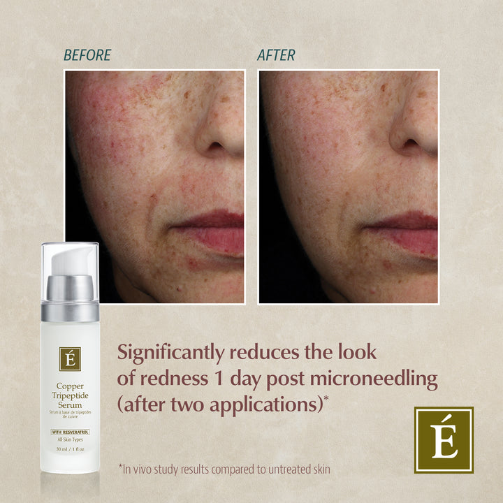 Before and after comparison of skin with a Eminence Organics Copper Tripeptide Serum product displayed.