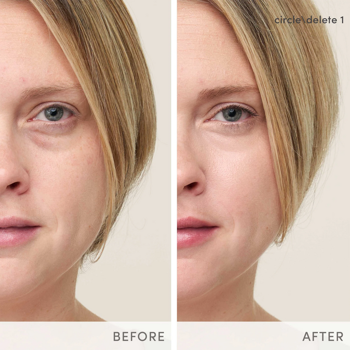 Jane Iredale Circle Delete Before after