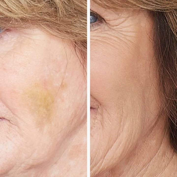 Jane Iredale Corrective Colors before and after