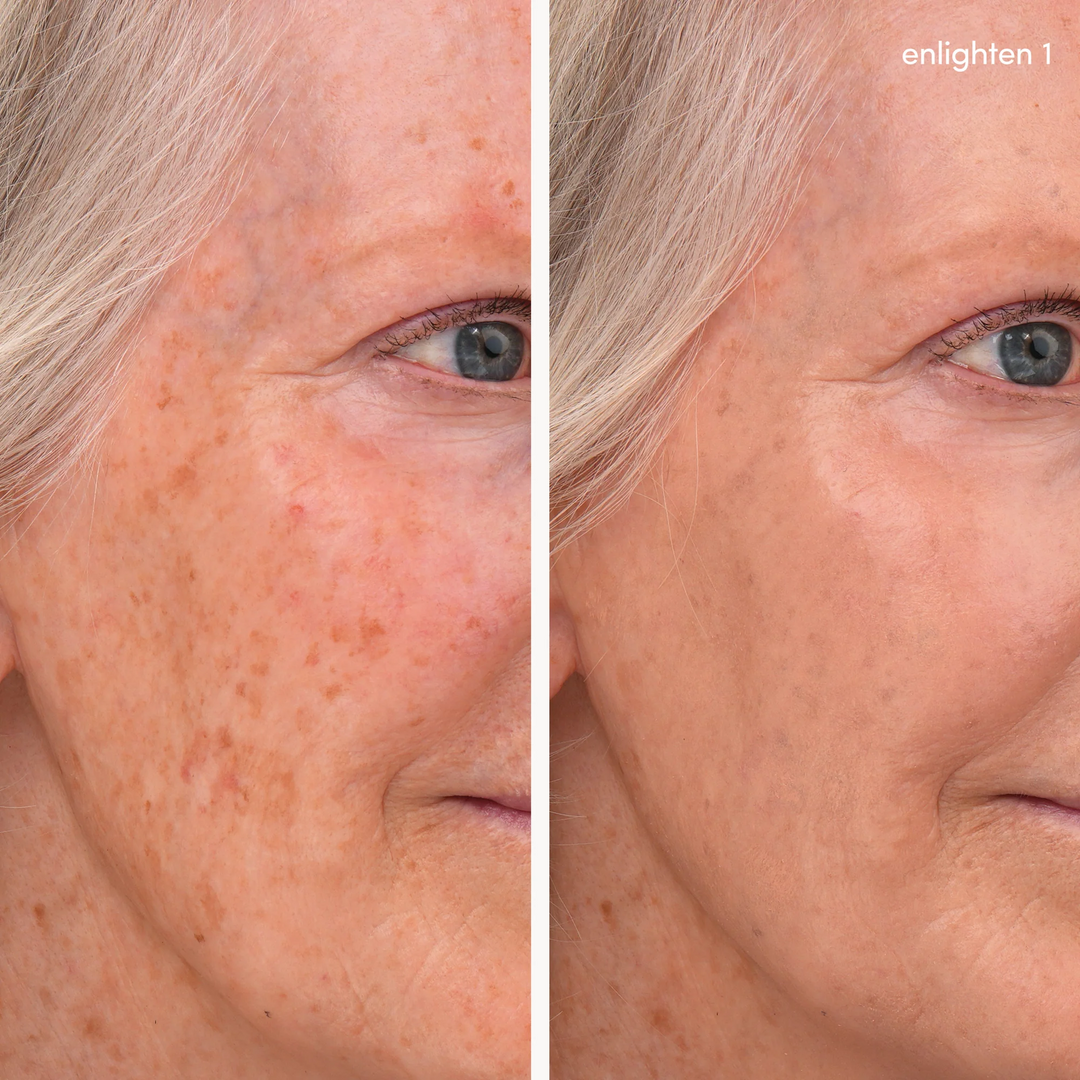 Jane Iredale Enlighten Concealer no 1 before and after model 