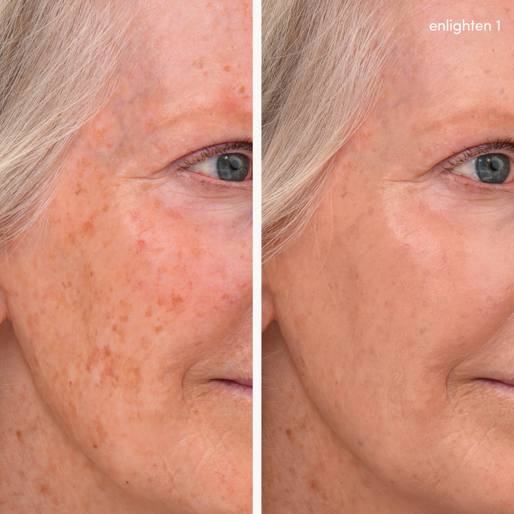 Jane Iredale Enlighten Concealer no 1 before and after model 