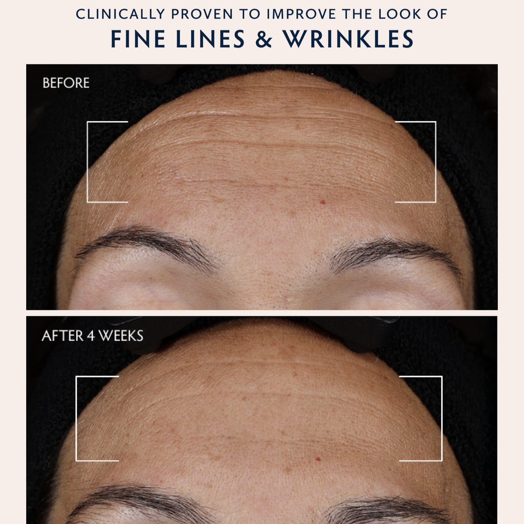 Before-and-after skincare comparison showing a person&