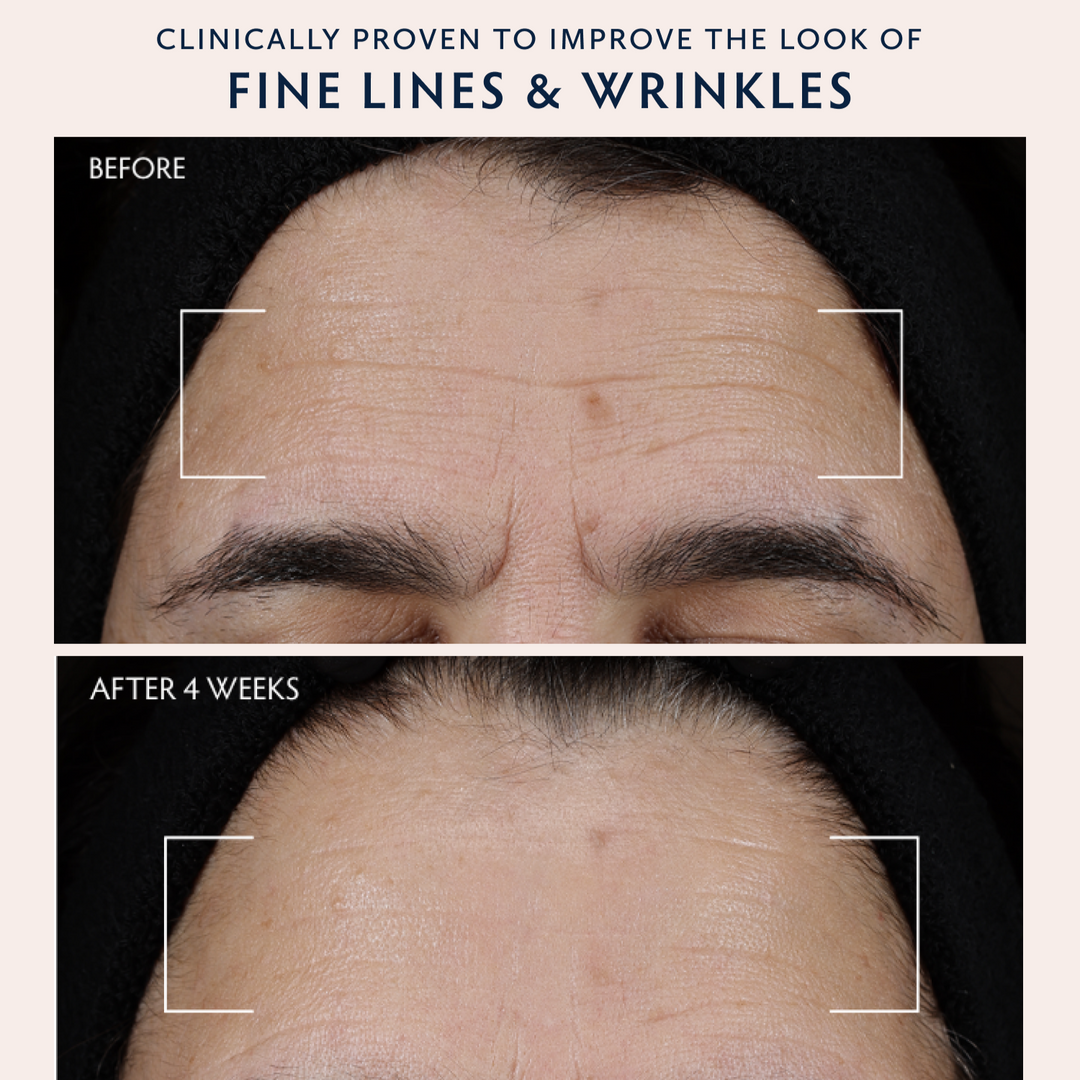 Before-and-after comparison of a person&