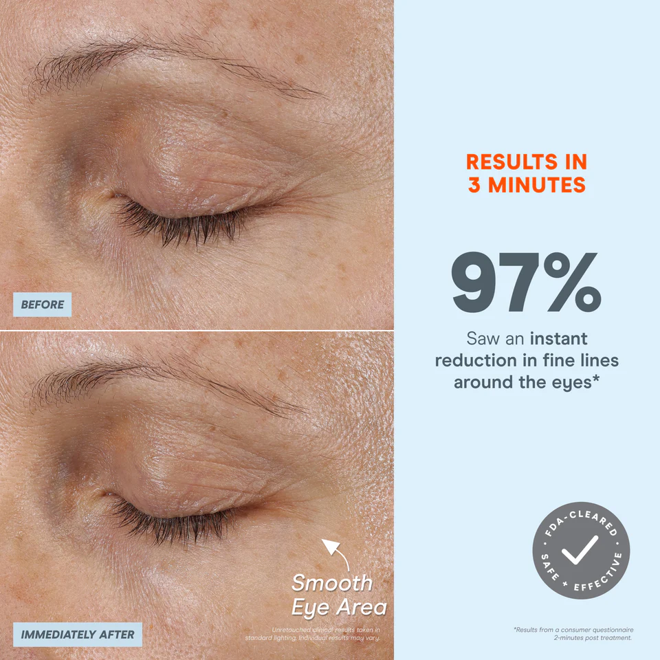 NuFACE FIX MicroWand before and after eyes