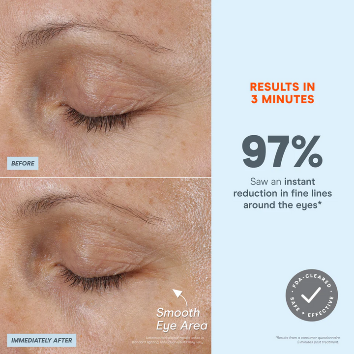 NuFACE FIX MicroWand before and after eyes