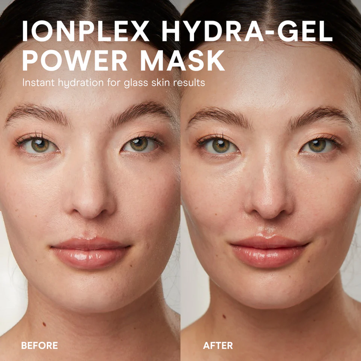 NuFACE IonPlex Hydra-Gel Power Mask before and after pictures