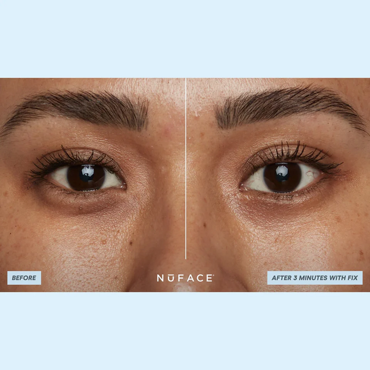 NuFACE IonPlex Hydra-Gel Power Patches before after