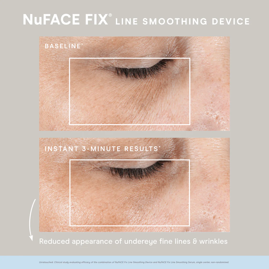 NuFACE FIX Starter Kit before after